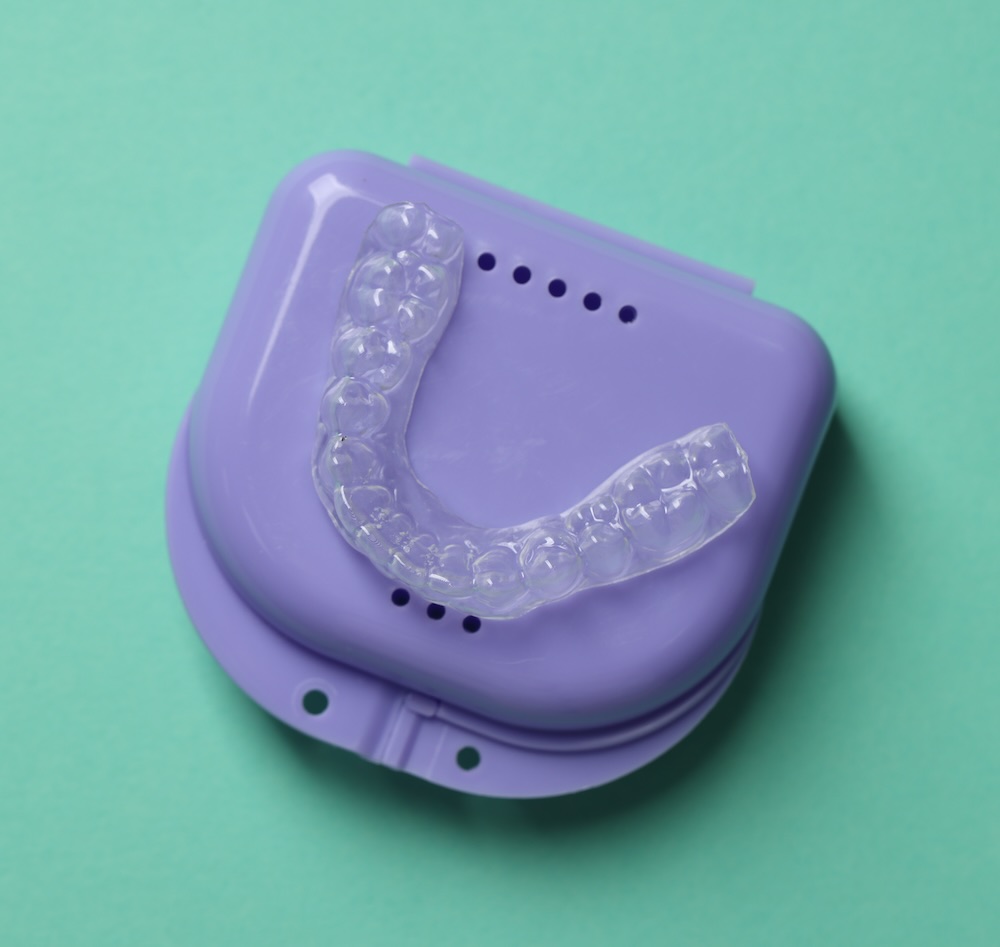 Guardas y retenedores en Cancún, en iSmile Dental Design Studio