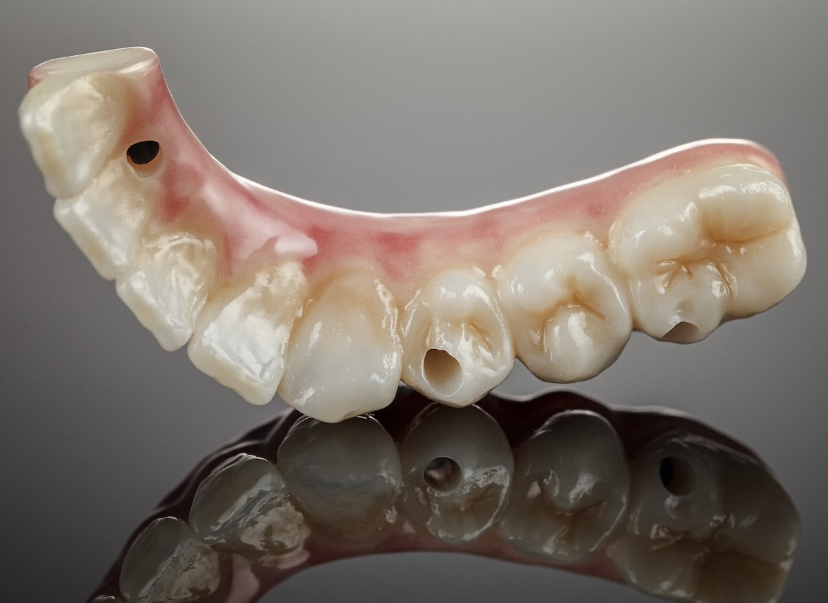 Smile makeover con zirconia